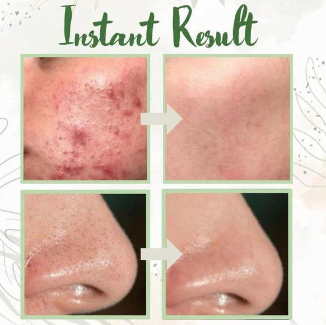 Green Tea Deep Cleanse Mask Stick: Pore Purifying, Oil Balancing Skincare Treatment